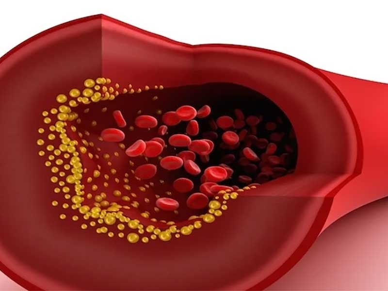 Gesamtcholesterin-Test