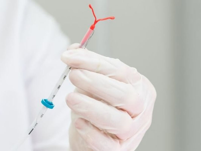 Intrauterinpessars (IUP)